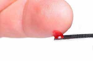 Für einen Blutgruppen Test genübt ein winziger Blutstropfen.