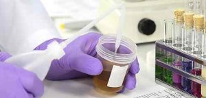 Ein Drogentest kann auf Basis von Urinproben in einem Labor oder zu Hause durchgeführt werden. 