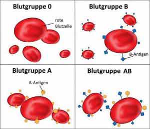 Blutgruppe AB ist die seltenste und jüngste aller Blutgruppen.