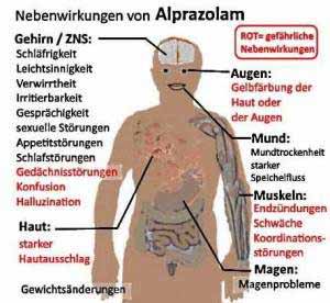 Benzodiazepine wie Alprazolam haben schwere Nebenwirkungen.