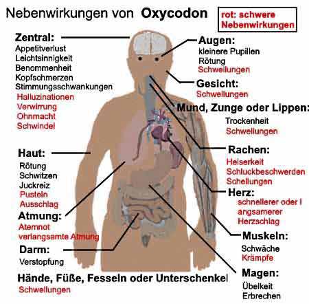 Nebenwirkungen und Suchtpotenzial von Oxycodon.