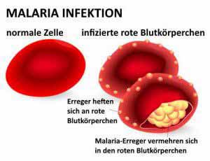 Der Malaria Erreger befällt die roten Blutkörperchen. 