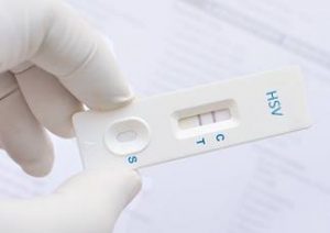 Ein Herpes Test für zu Hause schafft schnell Gewissheit!