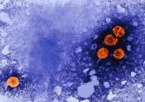 Unter dem Elektronenmikroskop werden die Viren sichtbar, die Hepatitis B verursachen.