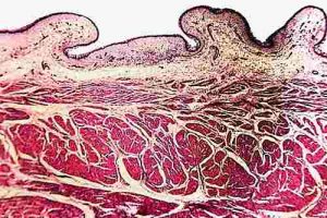 Bei einer mikroskopischen Gewebsuntersuchung lässt sich im Gewebe der Harnblase eine Blasenentzündung bei Katzen erkennen.